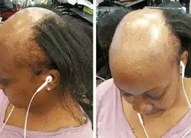 14822261595181108764523