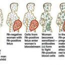 Your spontaneous miscarriages might be as a result of Rhesus factor