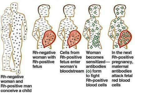 Your spontaneous miscarriages might be as a result of Rhesus factor