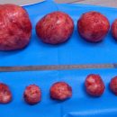 7 Signs That You May Have Fibroid