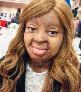 Singer Kechi 