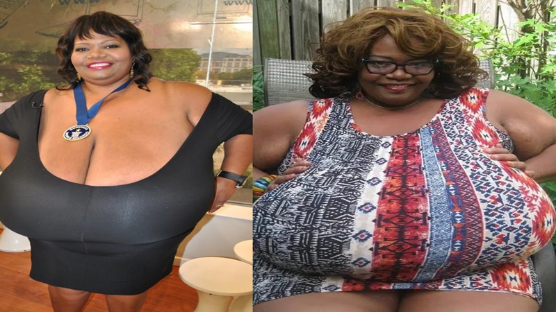 Woman with world's biggest breasts who is constantly attacked by