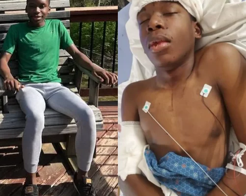Family describes black teen shot in head as "walking miracle"