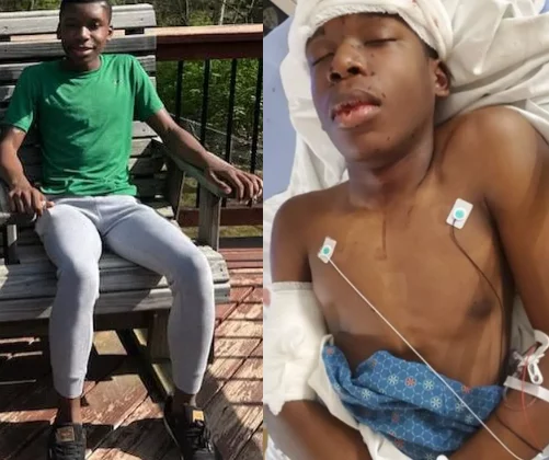 Family describes black teen shot in head as "walking miracle"