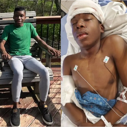 Family describes black teen shot in head as "walking miracle"
